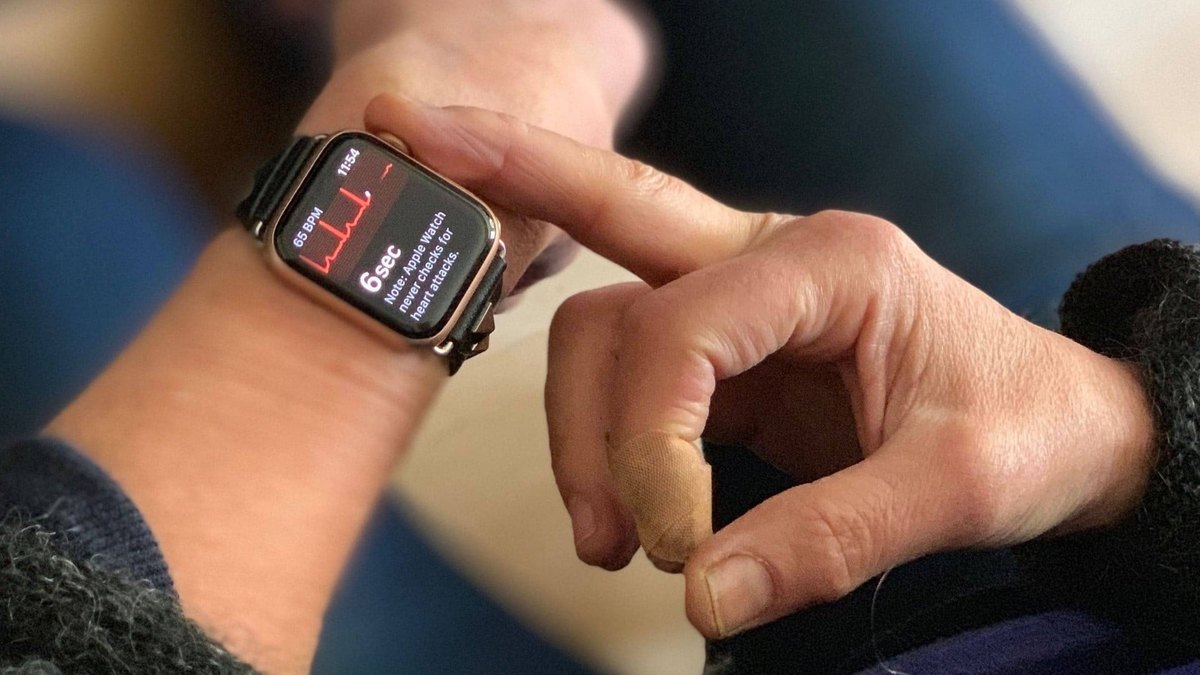 Melhores smartwatches com ECG e monitoramento cardíaco 2026